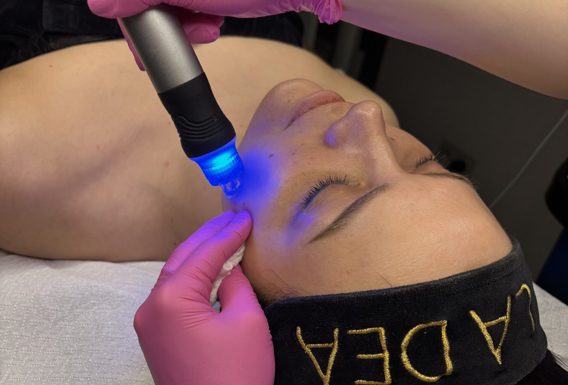 II zdjęcie Oczyszczanie wodorowe